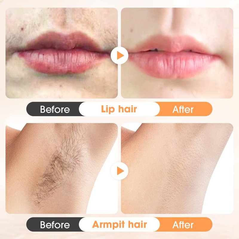 Hair Removal Cream for Women,2025 New Gentle Facial Hair Removal Cream With Scraper, Painless Hairs Removers for Body Face Lips (1)