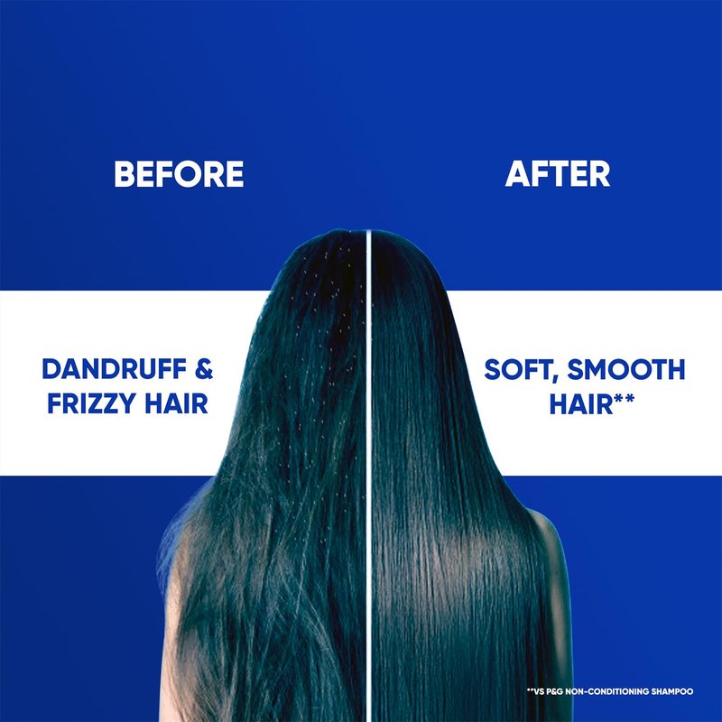 Head & Shoulders Smooth and Silky 2-in-1 Anti-Dandruff Shampoo & Conditioner | 180ml