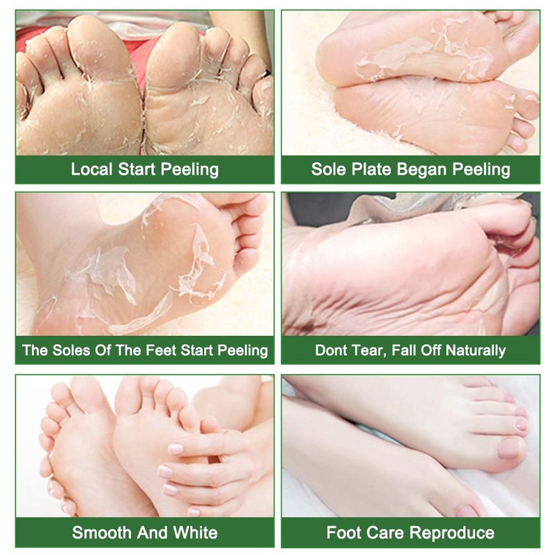 Liefiet Foot Peeling Mask 5 Pack, Foot Mask Remove Dead Skin, Rough Callus and Cracked Heels, Dry Skin Moisturizer for Soft and Smooth Baby Touch Feet (Tea Tree)
