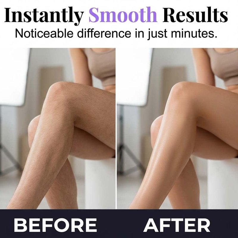 Skiennix Hair Removal Cream - Gentle Bikini & Body Hair Remover for Smooth Skin | Large Size