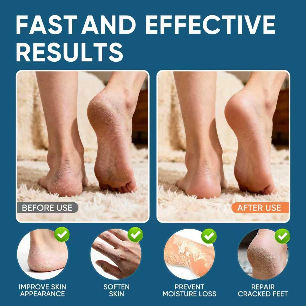 VREKEF Urea Cream 60% with 2% Salicylic Acid, Urea Cream 60 Percent for Feet Maximum Strength, Foot Cream & Callus Remover for Dry Cracked Heels, Rough Thick Skin, Deep Hydration, 5.29 oz