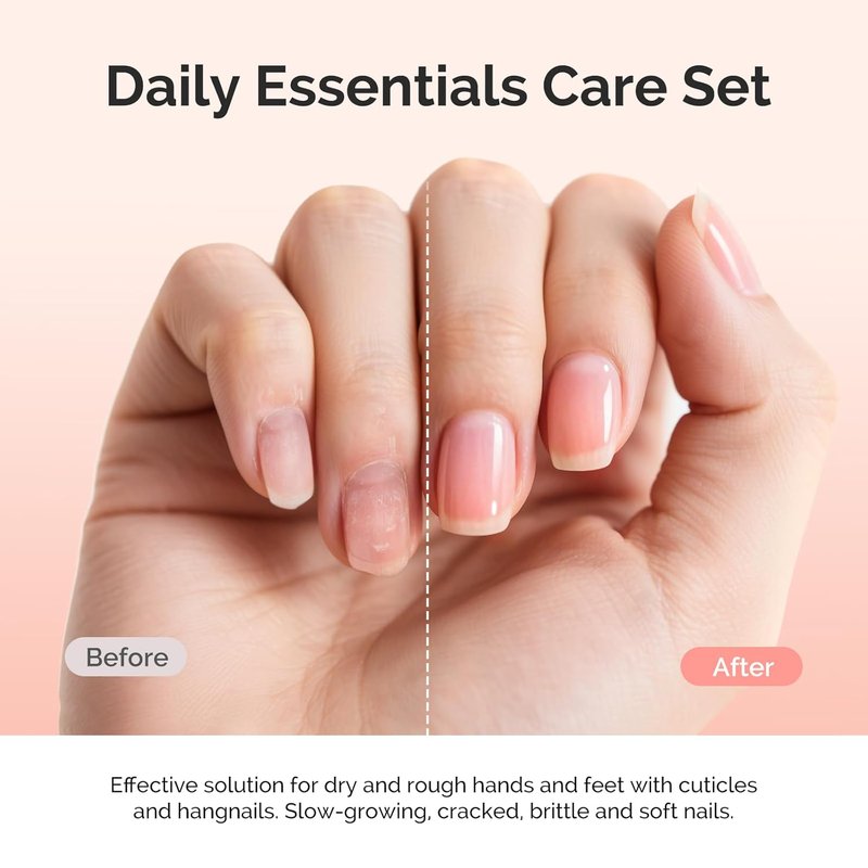 Cuticle Care Kit - Nourishing Cuticle Oil & Remover for Nail Growth | 25ML, 2PCS