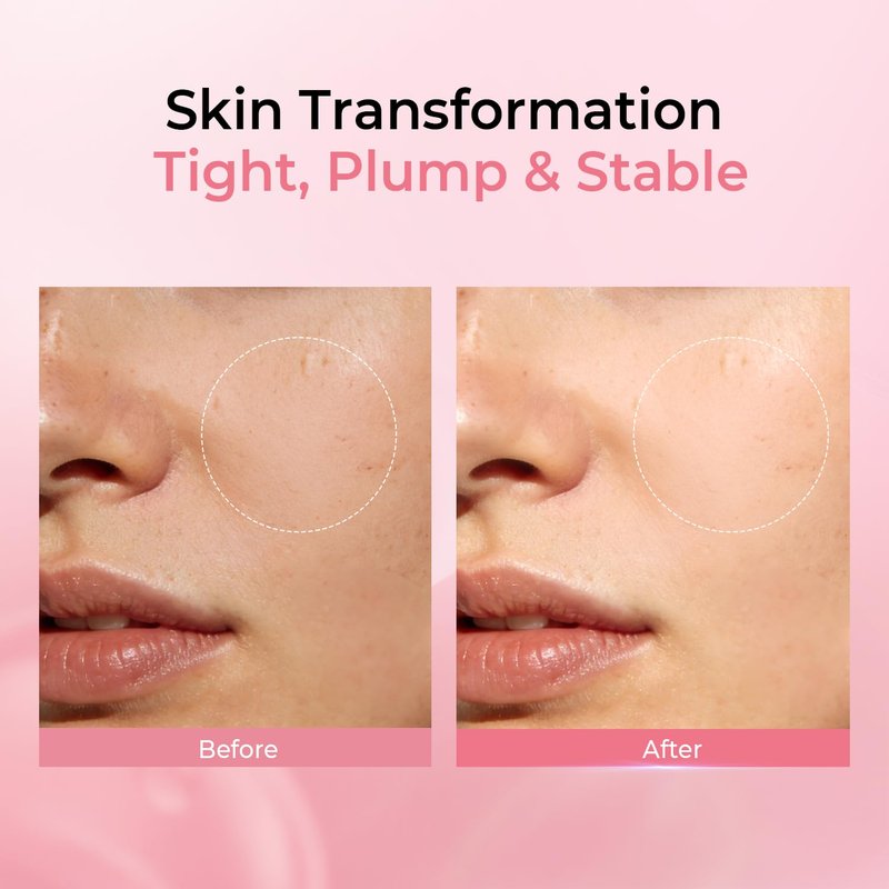 PROF.LING Real Deep Hyaluronic Acid Glow Mask, Tranexamic Acid & Niacinamide Face Mask, Deep Hydrating & Soothing Mask for Redness-Prone, Dry Skin, Brightening & Moisture, Korean Skincare，28g x 5ea