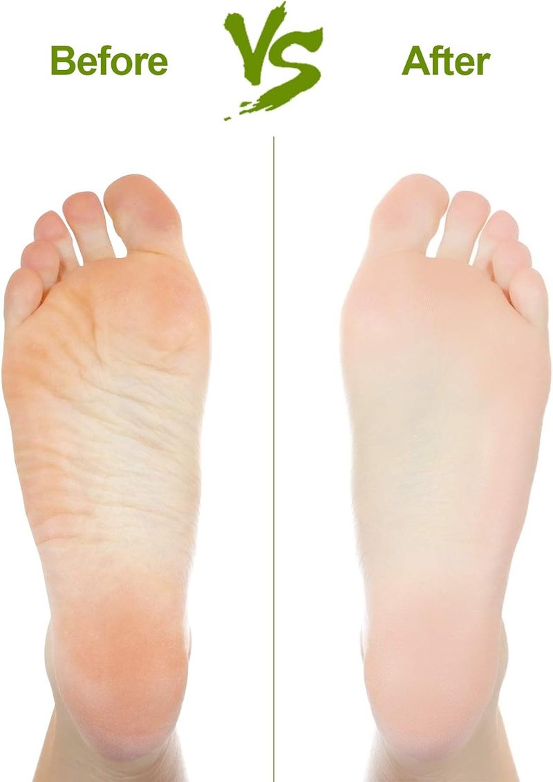 Natural Pumice Stone Set - Effective Callus Remover for Feet & Hands | Exfoliating Pedicure Tools (2PCS)