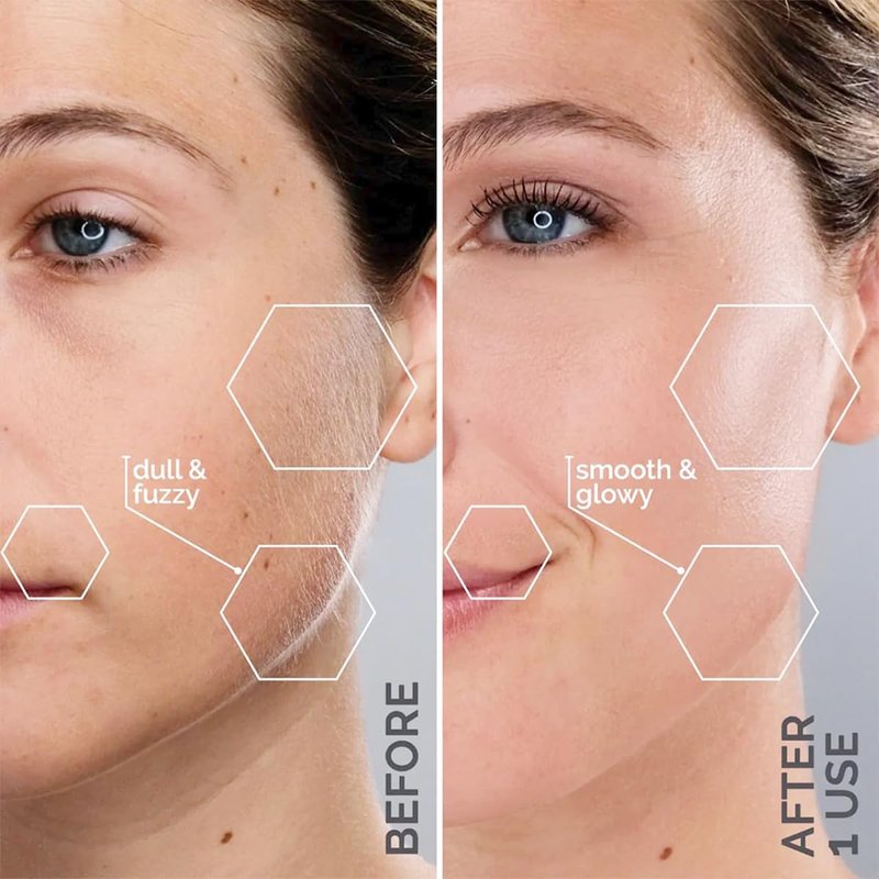 Michael Todd Beauty Sonicsmooth Dermaplane Razor - Women's Face & Eyebrow Trimmer | 8 Weeks of Blades