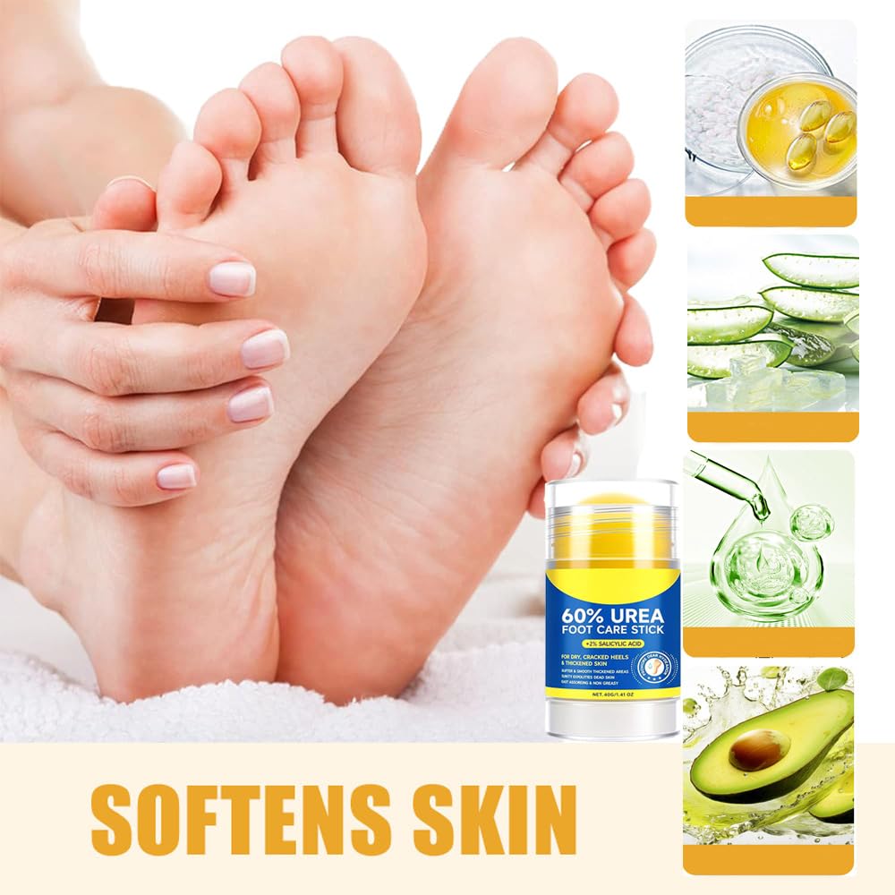 LmiiSanHoo 60% Urea Hydrating and 2% Salicylic Acid Foot Care Cream, Upgraded Care Cream Repairs and Hydrates Dry and Cracked Feet and Hand, Moisturising and Relieves Foot Cream for Man and Women (1)