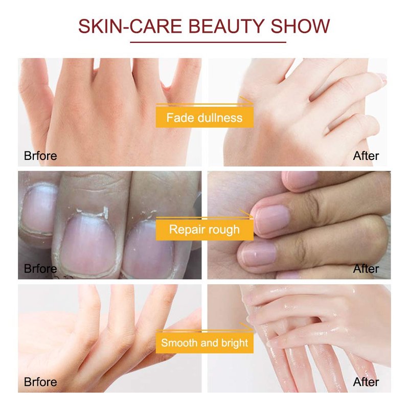 Moisturizing Hand Peeling Mask - 5 Pack Repairing Gloves for Dry Skin | Honey & Milk Formula