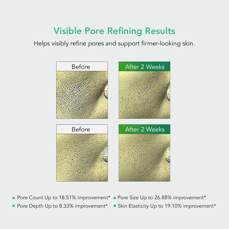 Leaders Pore Tightening Toner Pads - Triple-Action Pore Improvement | Vegan & Clinically Proven | 50 Pads x 170ml