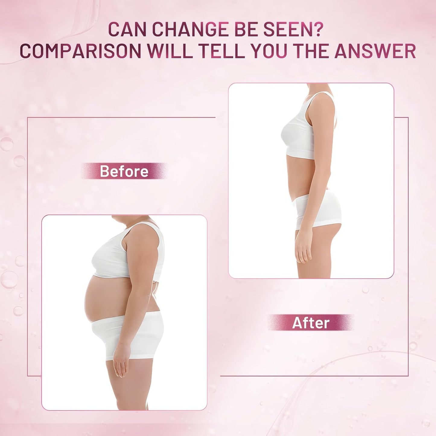 ZZILME B TIGHT Cellulite Cream, Body Firming & Tightening Cream for Thighs, Butt & Stomach, Smooths the Look of Uneven Skin, Lightweight Fast-Absorbing Moisturizer, Korean Skincare, 4.23 Fl Oz