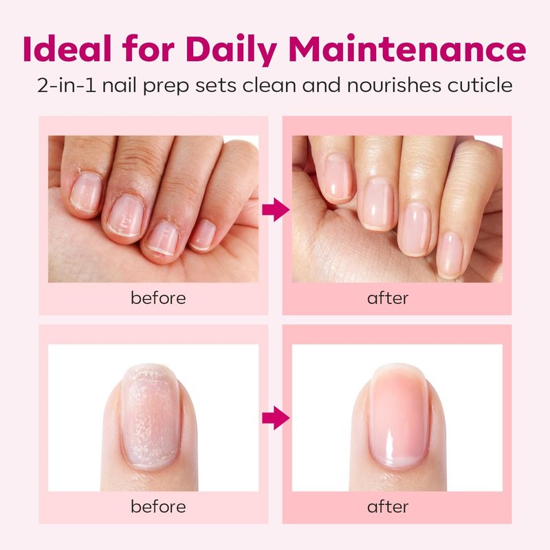 Modelones Cuticle Remover Kit - Complete Nail Care Set with Liquid, Oil Pen, Trimmer & Nipper