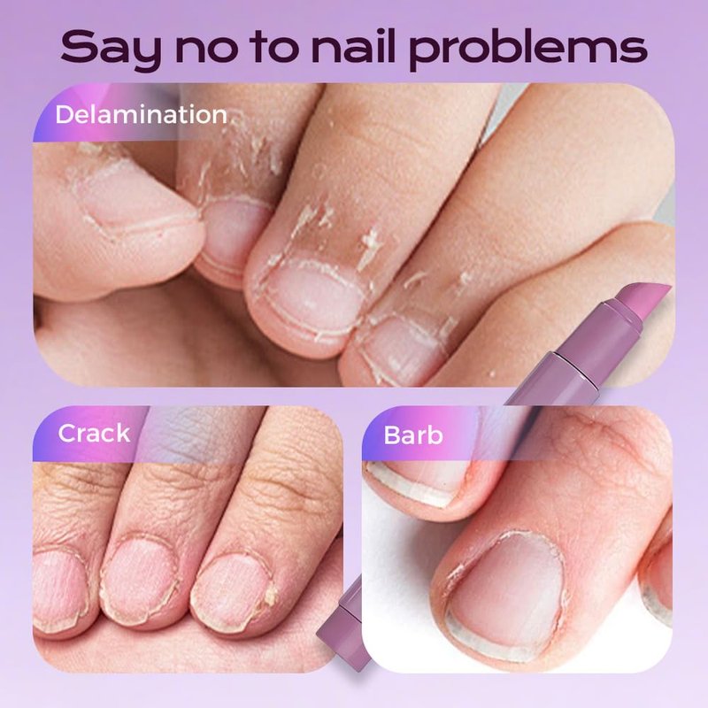Cuticle Treatment Pen - 3-in-1 Nail Care for Hangnails & Damaged Cuticles | Ceramic Tip, Purple