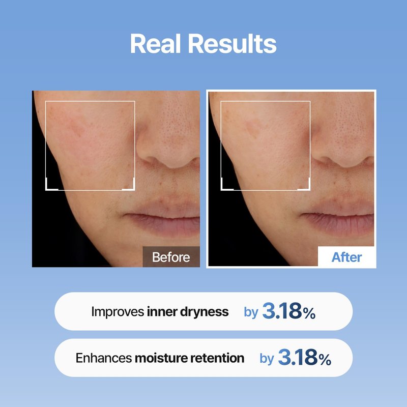 MEDITHERAPY Hyaluronic Acid Serum - Ultra Hydrating 150ml | Non-Sticky Anti-Aging Face Moisturizer for Glowing Skin
