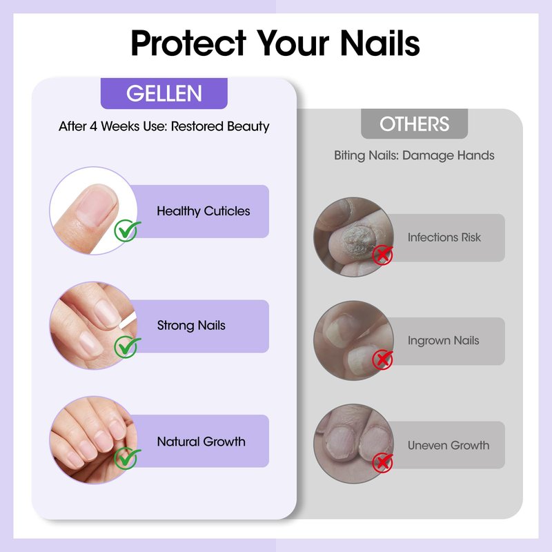 Gellen Nail Biting Treatment for Kids & Adults - 15ml Safe Nail Biting Prevention Thumb Sucking Deterrent Bitter Taste No Biting Nail Polish Nail Care Solution to Help Stop Finger Biting & Nail Repair