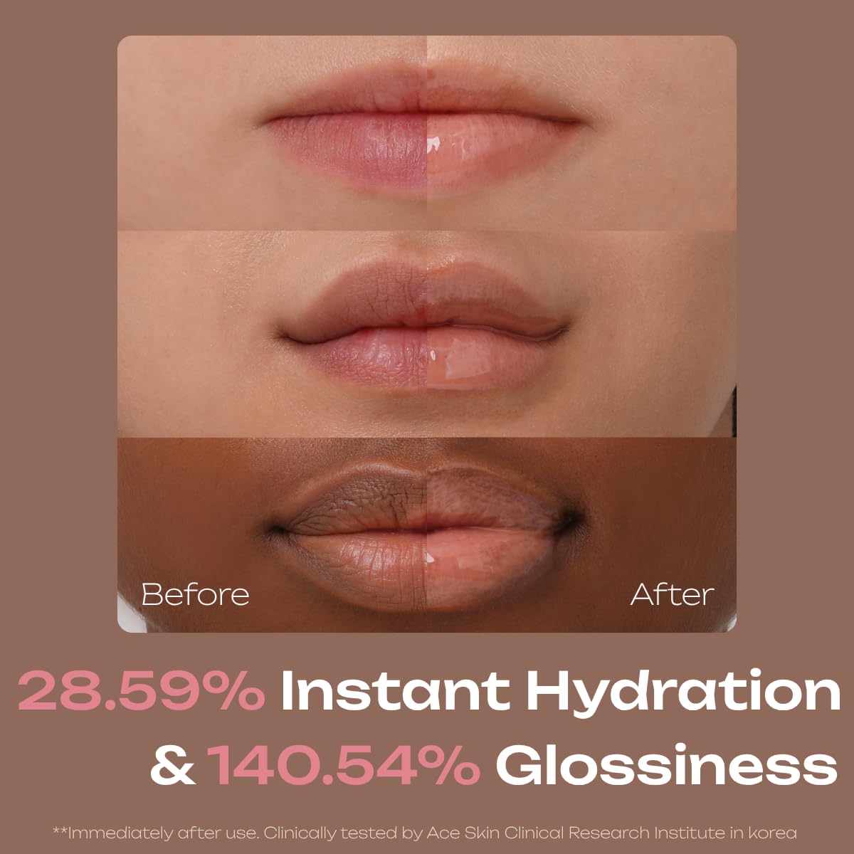 Losy Kim PDRN Tinted Lip Serum – High Gloss Ultra Hydrating Natural Glow, Non-Sticky Volumizing Color Glaze with Long-Lasting Shine, Nourishing Moisturizing Repair for Chapped Lips (0.34 oz) (island)