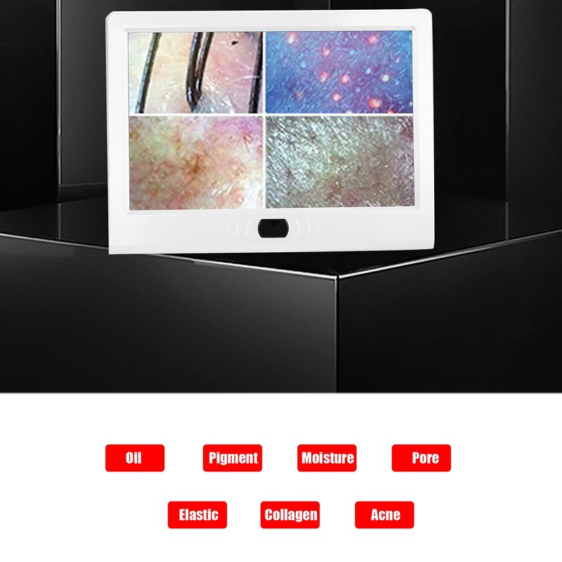Dioche Skin Diagnosis Hair Analyzer 12inch Skin Scalp Camera Detector MultiFunctional Rechargeable Hair Follicle Skin Analyser Machine or Home Spa Salon Use