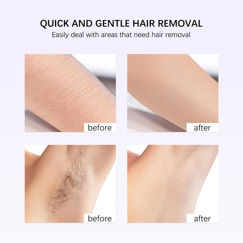 Hair Removal Cream for Women & Men, 100ml Gentle Formula with Shea Butter, Smooth Skin in Minutes, Painless Body Hair Remover for Legs, Arms, Underarms (1PC)