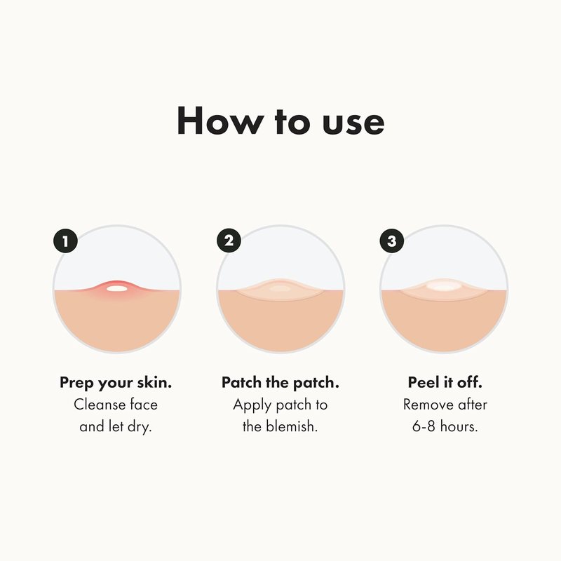 Mighty Patch Original | Hydrocolloid Acne Pimple Patches - Shrink Zits & Whiteheads Fast (72 Count)