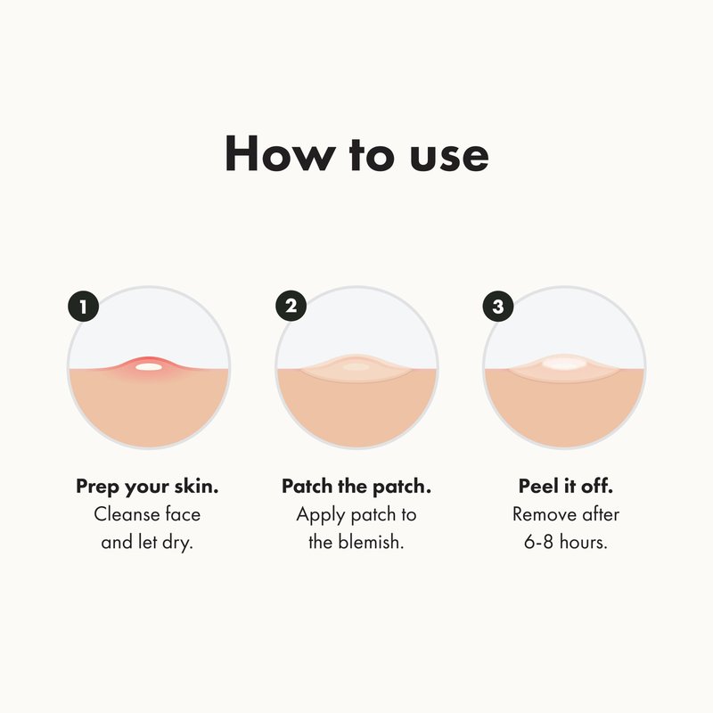 Mighty Patch Original from Hero Cosmetics - Hydrocolloid Acne Pimple Patch for Zits and Blemishes, Spot Treatment Stickers for Face and Skin, Vegan and Cruelty Free (36 Count)