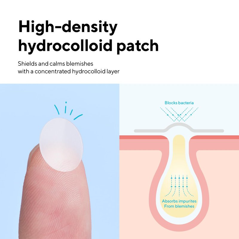 caraseoul Pimple Patches, 2 Size Hydrocolloid Acne Patch for Zits and Blemishes, Bakuchiol & Aloe Vera, Korean Skin Care, Easy to Use – Dermatology Tested (102 Count)