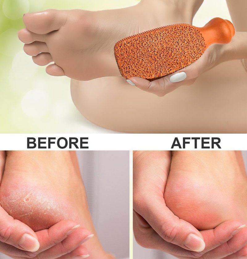 QUBA LINEN Pumice Stone for Feet – 2-Sided Terra Cotta Foot Scrubber, Natural Callus Remover for Dry Skin & Rough Heels, Cracked Heels – Pedicure Exfoliator for Feet Hands Body
