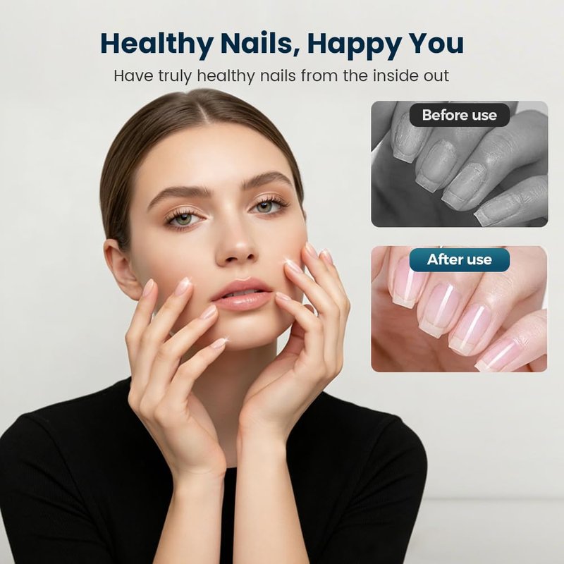 3 Days Nail Care Oil, 2026 Upgraded Keratin Nail Strengthener, Nail Moisturizer Gloss for Brittle Nails, for Women (3pcs)