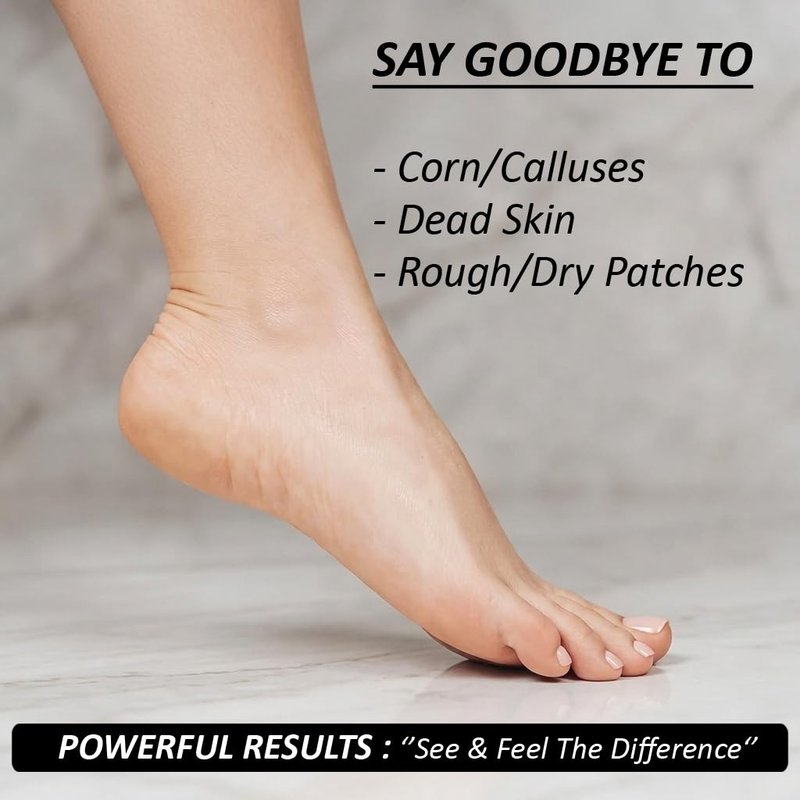 Foot Callus Shaver (Silver)