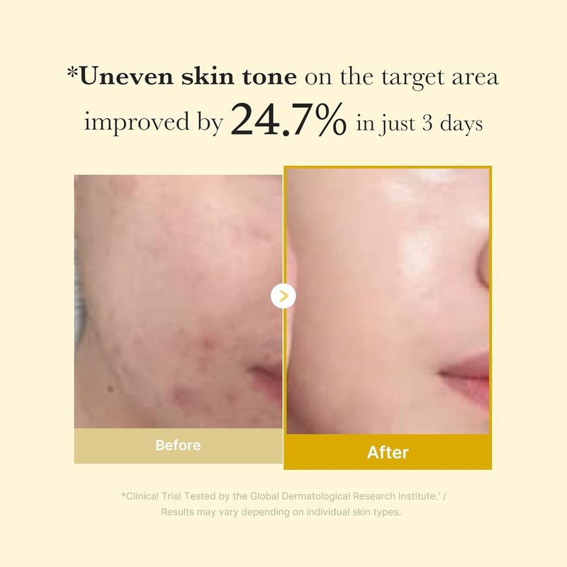 Kojic Acid Turmeric Overnight Peel Off Mask - Brightens & Defends Skin Stress | 2.53 fl. oz.