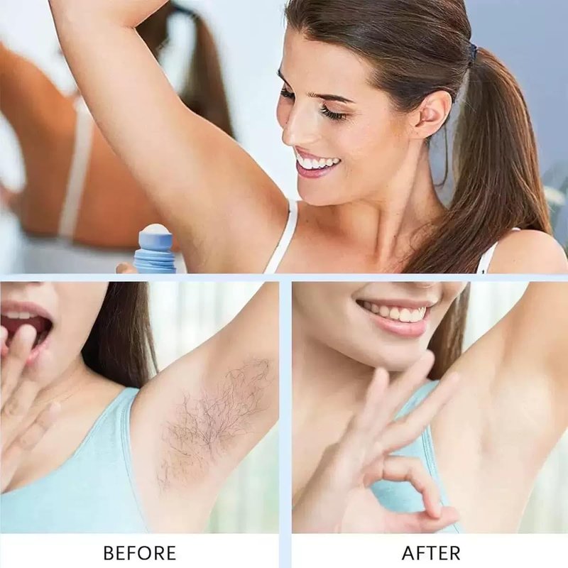 Ingrown Hair Treatment Serum - Smoothing Solution for Razor Bumps & Bikini Line | Soothing Aftercare for Soft Skin
