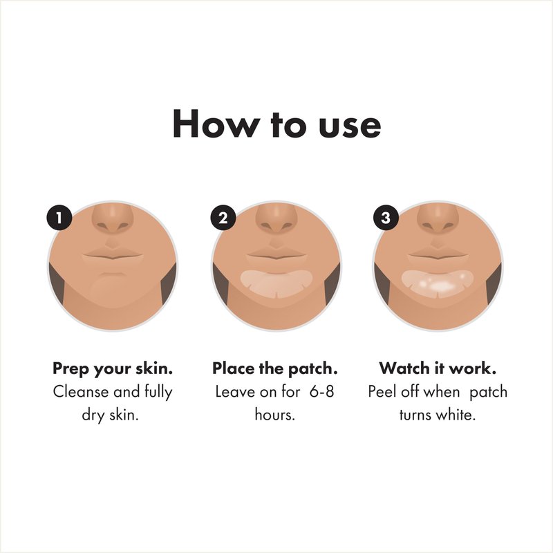 Mighty Patch Hero Cosmetics Chin Patch - XL Contoured Hydrocolloid Chin Patch for Blemishes and Pimples - Non-Irritating (10 Count)