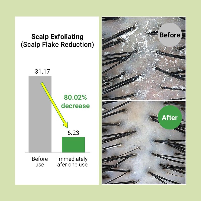 RATED GREEN Real Mary Exfoliating Dry Scalp Shampoo, 13.52 fl oz - Organic Rosemary Hair for Itchy , Gentle Scalp Moisturizer, with Ginger & Peppermint Oil