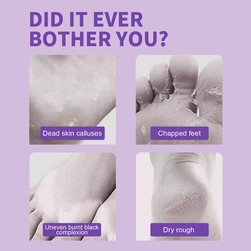 Exfoliating Foot Peel Mask - 5 Pack for Dry, Cracked Feet | Lavender & Shea Butter, Softens Skin