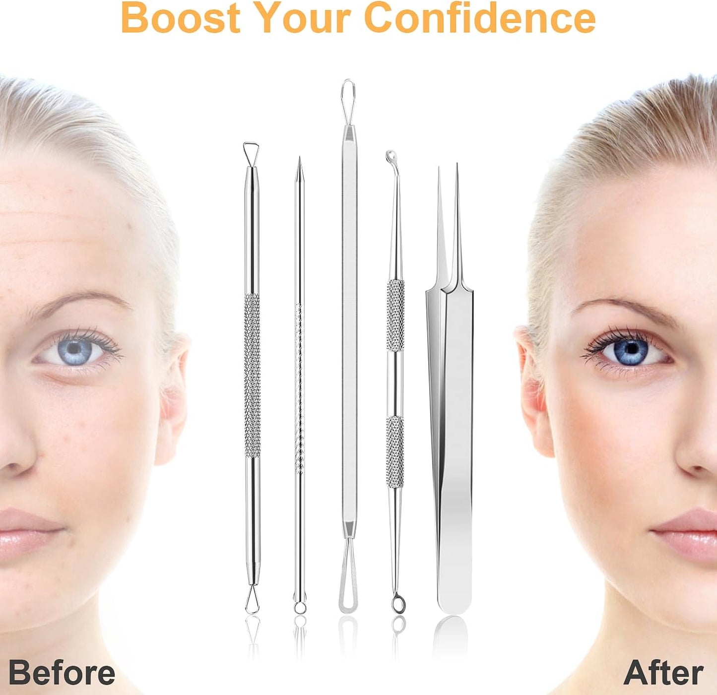 UUBAAR Blackhead Remover Tool Kit - 9PCS Stainless Steel Comedone Extractors with 2 Tweezers & Leather Case