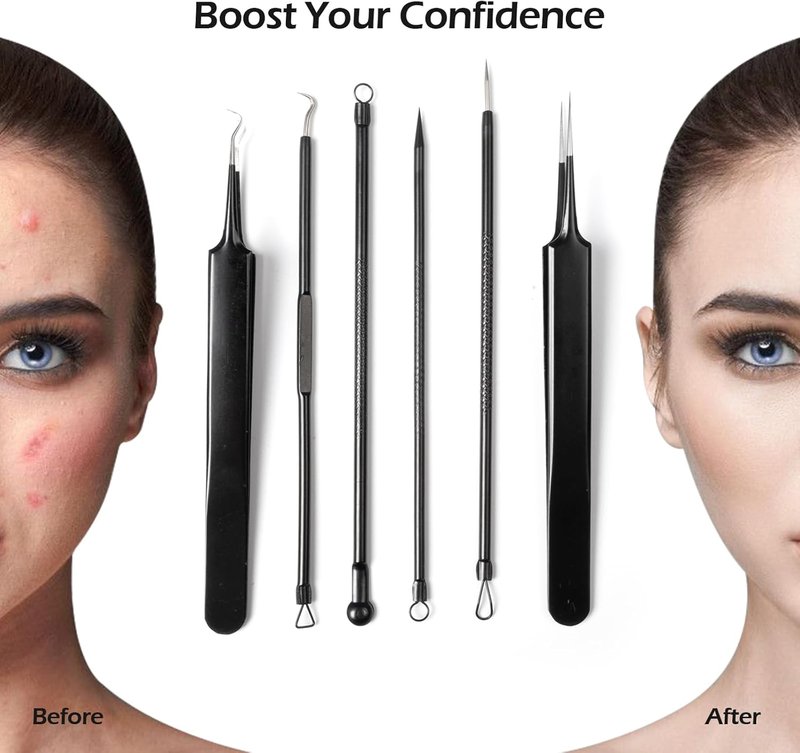 Skiennix Blackhead Remover Tool Kit - 6-Piece Pimple Popper Set for Clear Skin | Black