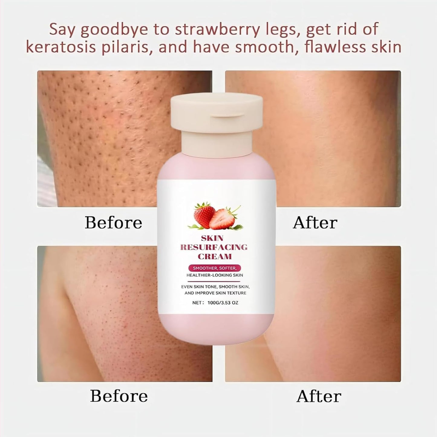 Soelegant Strawberry Skin Resurfacing Cream with Lactic Acid - Exfoliating Body Cream for Bumpy Rough Skin on Arms Legs, Deep Hydration Moisturizing, Smoothing & Renewal, 3.53 OZ