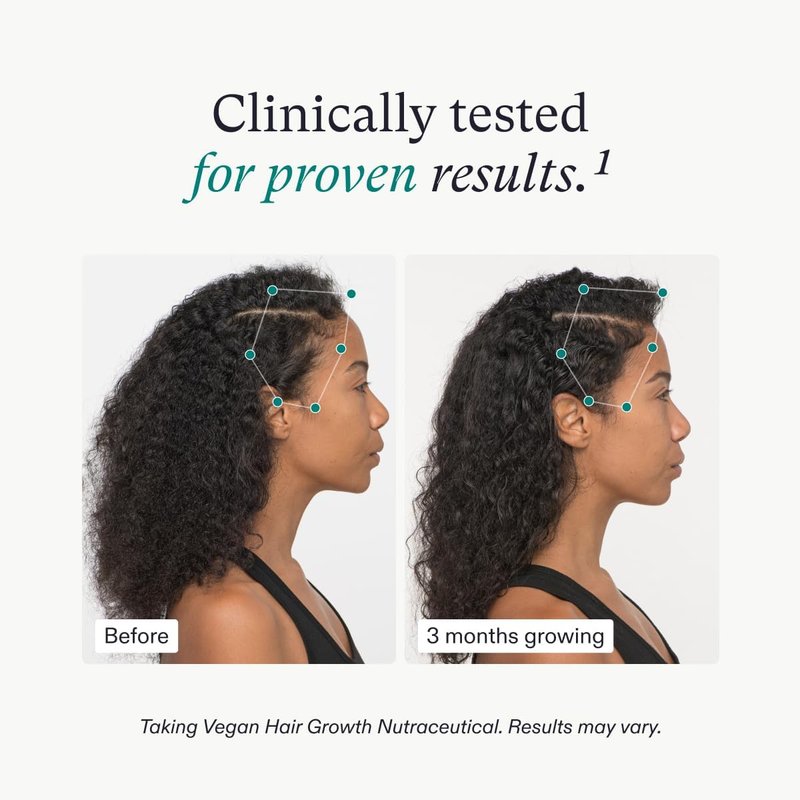 Nutrafol Women's Hair Growth Supplements, For Women 18-44 Years Old, Clinically Tested for Visibly Thicker, Stronger Hair, 100% Vegan Ingredients, Dermatologist Recomme - 3 Month Supply, 1.7 oz Bottle