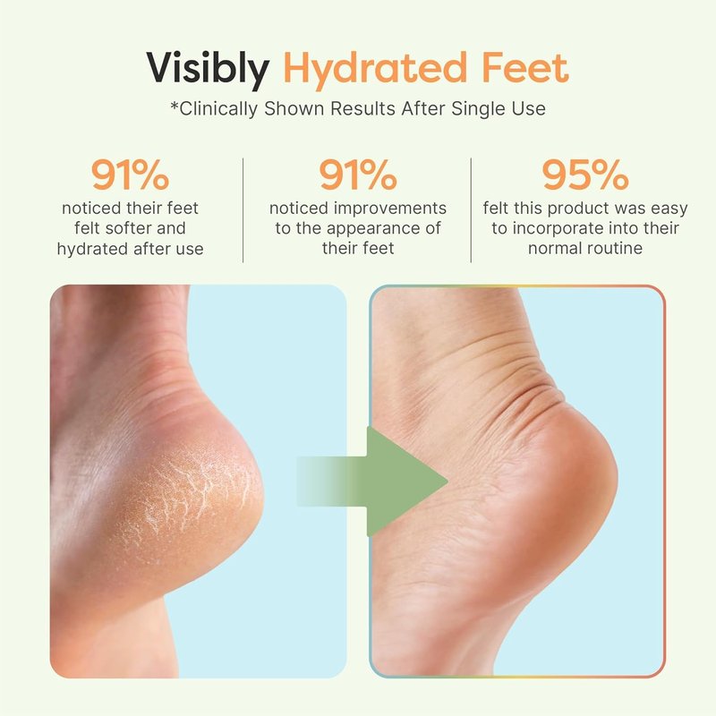 Moisturizing Socks for Cracked Heels - Vitamin E & Olive Oil Infused | Cheetah Print, Regular Size