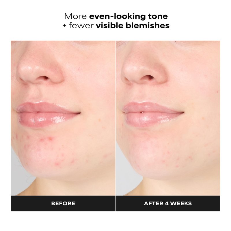 Paula's Choice SKIN PERFECTING 1% BHA Exfoliating Gel Toner for Sensitive Skin, Gentle Facial Smoother with Salicylic Acid and Allantoin for Redness, Clogged & Enlarged Pores, Fragrance-Free