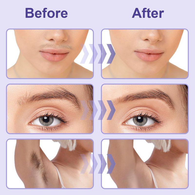 Face Waxing Kit for Women, Facial Wax Kit, Silicone Eyebrow Wax Kit, Microwave Upper Lip Hair Removal with 100g Wax Beads