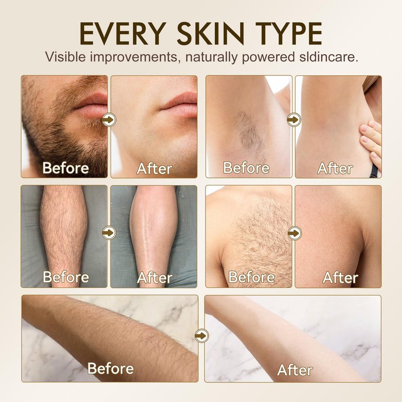 Cyperus Rotundus Oil, Natural for Reducing Body Hair Growth, Cyperus Rotundus Oil for Hair Removal, Reduces Unwanted Hair Growth, Reducing Body Hair Growth, Shrink Pores - 2.02 Fl Oz