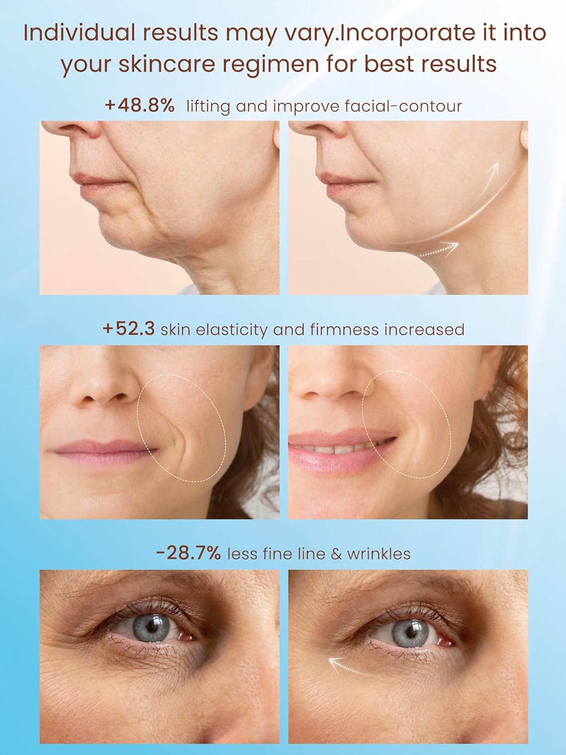 Skiennix Radio Frequency Skin Tightening Device - Smart Electric Facial Beauty Machine for Jawline Lifting & Wrinkle Reduction