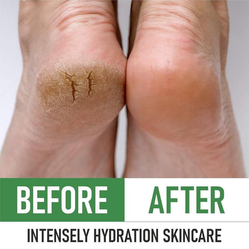 PurOrganica Urea Cream 40% - Maximum Strength Foot Cream for Dry, Cracked Heels | Exfoliating Moisturizer 4 oz