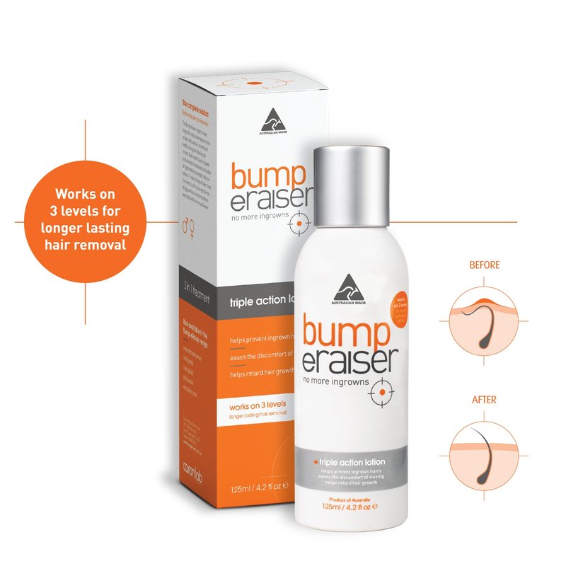 Bump eRaiser Triple Action Lotion 4.2 fl oz — Daily Ingrown Hair & Razor Bump Lotion for Bikini Line, Legs, Beard & Underarms | 3-in-1 Pre & Post Shave | Alcohol Free | Vegan | Made in Australia