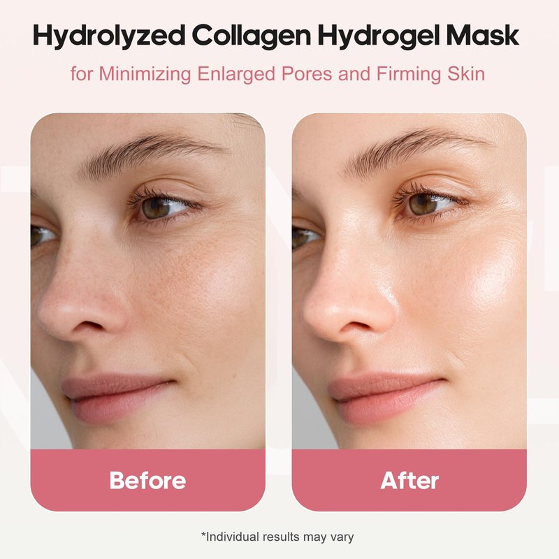 NLQ Collagen Face Mask Overnight Hydrogel Deep Mask - Glass Skin Intensive Hydrating & Firming Pore Refining Anti-Aging Sheet Mask, Skincare Gift for Women (5 Sheets)