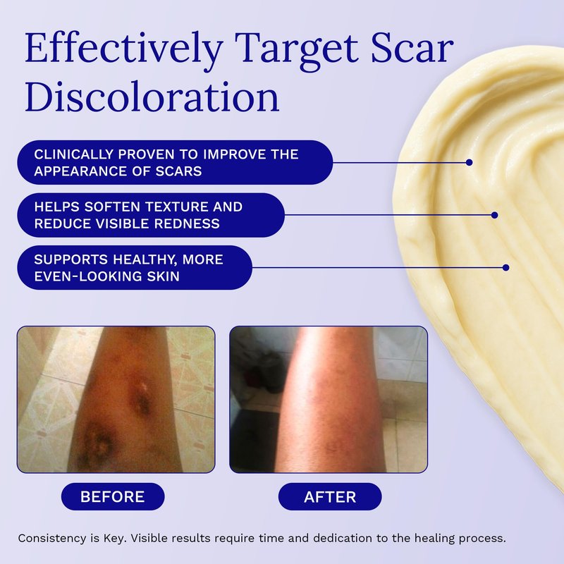 Rejuvaskin RejuvaSil Silicone Scar Gel, Scar Treatment for Surgical Scars, Burns, Keloids, Acne Scars on Face & Body, 30ml