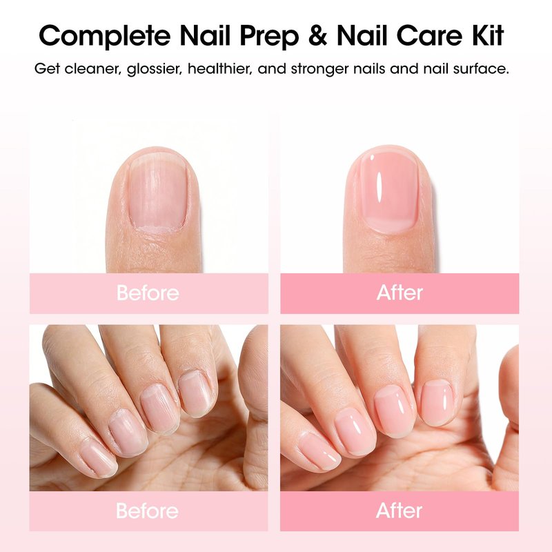 Gellen Nail Care Kit Manicure Tools Kit: Nail Strengthener and 2Pcs Nail File & Buffer 100/180, Cuticle Pusher Pen, Cuticle Oil & Remover, Fork | Nail Clipper & Brush