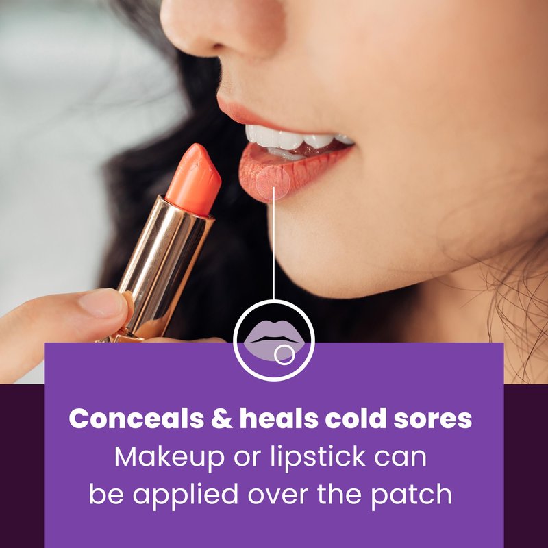 Mederma Cold Sore Discreet Patch - Hydrocolloid Gel, Relieves Redness & Swelling, Conceals Cold Sores