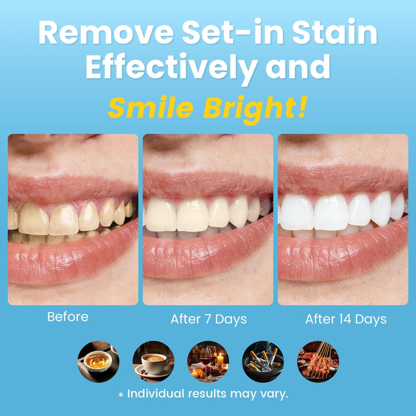 Carerus Teeth Whitening Strips, 8 Treatments, Hydroxyapatite Formula for Sensitive Teeth, Enamel-Safe & Residue-Free, Gentle Tooth Whitener, Mint, Last-Minute Hangouts (16 Strips)