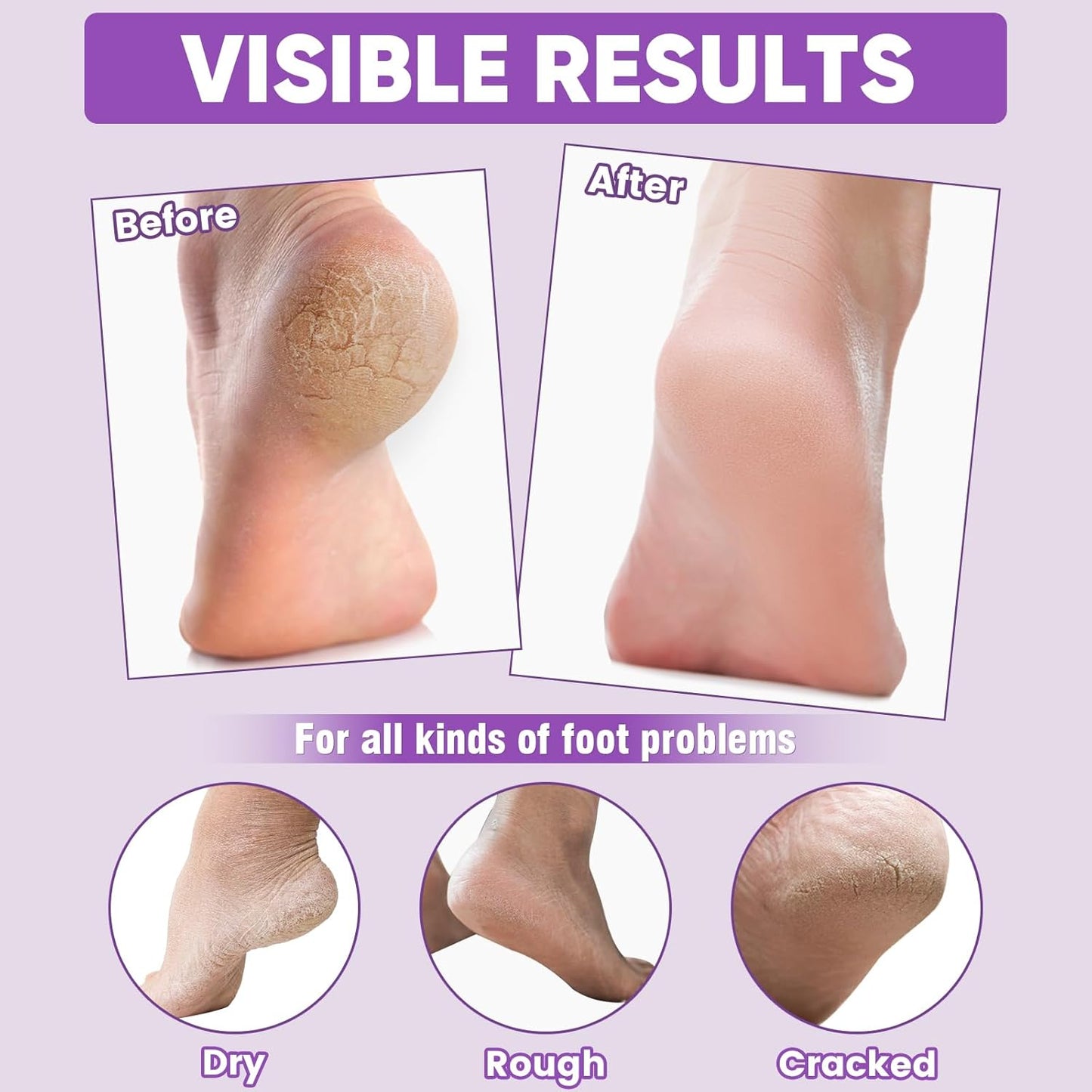 TEAWOO Moisturizing Foot Masks - 24 Pairs with Lavender & Jojoba Oil for Dry, Cracked Feet