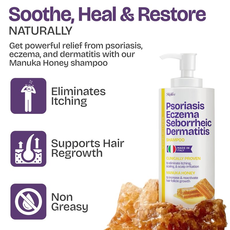 Psoriasis Shampoo for Eczema, and Folliculitis Treatment - Seborrheic Dermatitis Antifungal Shampoo for Ringworm, Acne, Flaking, Dry & Itchy Scalp Treatment - Psoriasis Relief with Manuka Honey