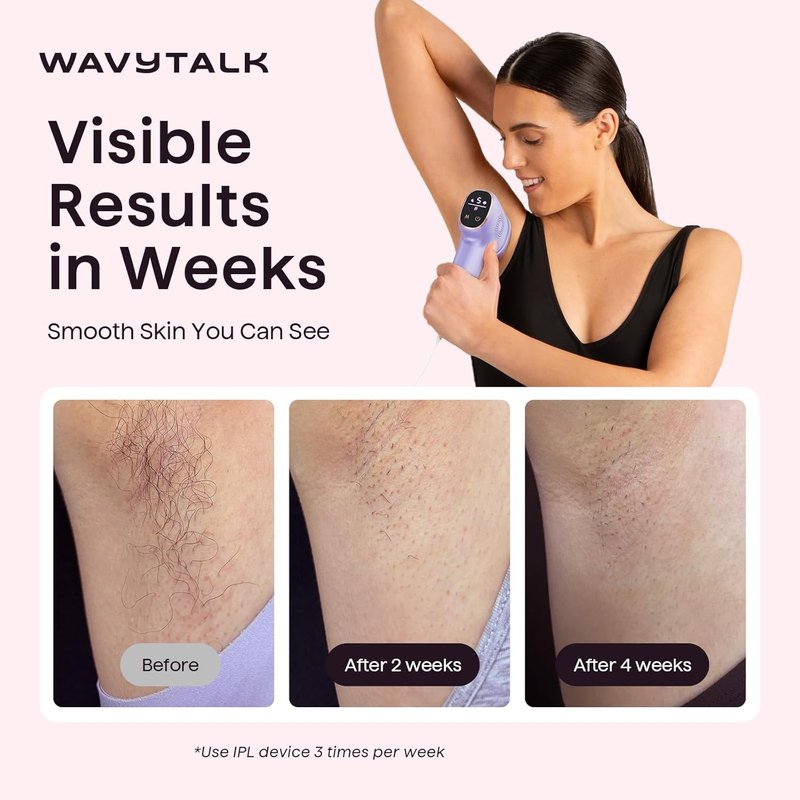 IPL Hair Removal Device - Precision Roller for Face, Body & Bikini | Painless, Long-Lasting Results, At-Home Use